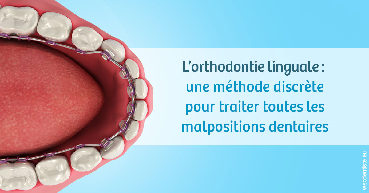 https://dr-perotti-laurent.chirurgiens-dentistes.fr/L'orthodontie linguale 1