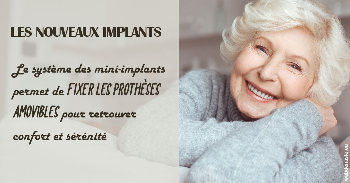 https://dr-perotti-laurent.chirurgiens-dentistes.fr/Les nouveaux implants 1