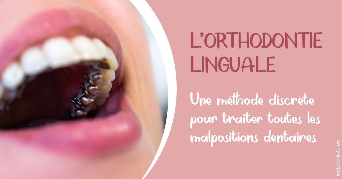 https://dr-perotti-laurent.chirurgiens-dentistes.fr/L'orthodontie linguale 2
