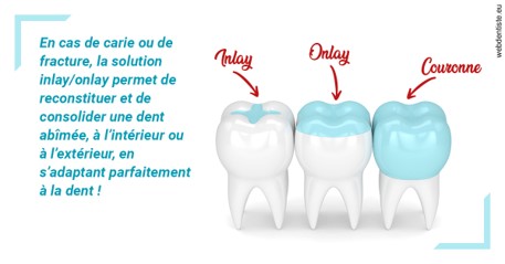 https://dr-perotti-laurent.chirurgiens-dentistes.fr/L'INLAY ou l'ONLAY