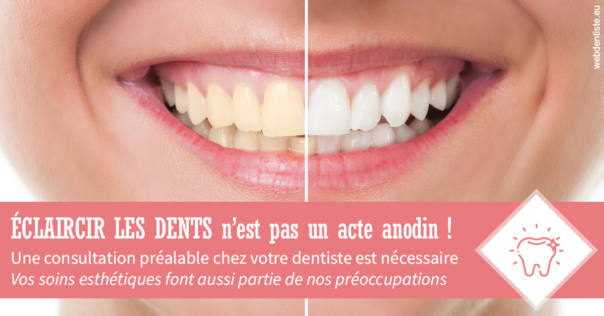 https://dr-perotti-laurent.chirurgiens-dentistes.fr/Eclaircir les dents 1