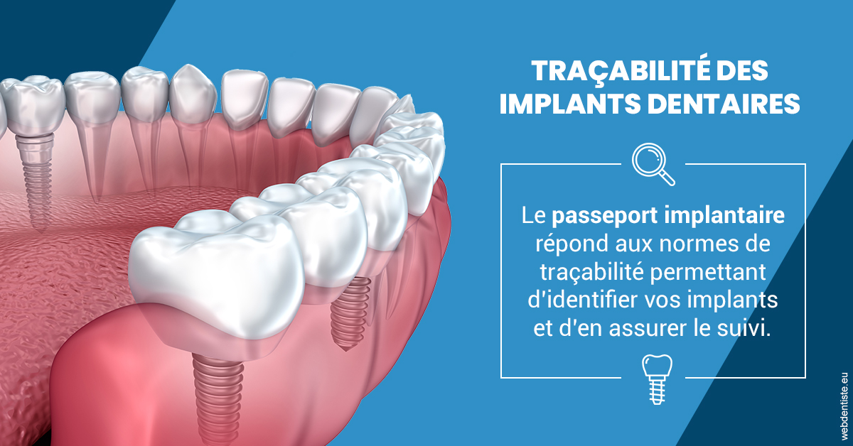 https://dr-perotti-laurent.chirurgiens-dentistes.fr/T2 2023 - Traçabilité des implants 1