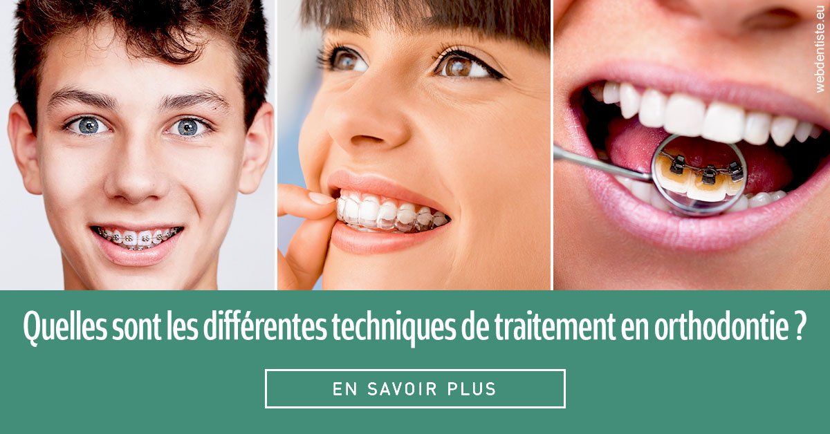 https://dr-perotti-laurent.chirurgiens-dentistes.fr/Les différentes techniques de traitement 2