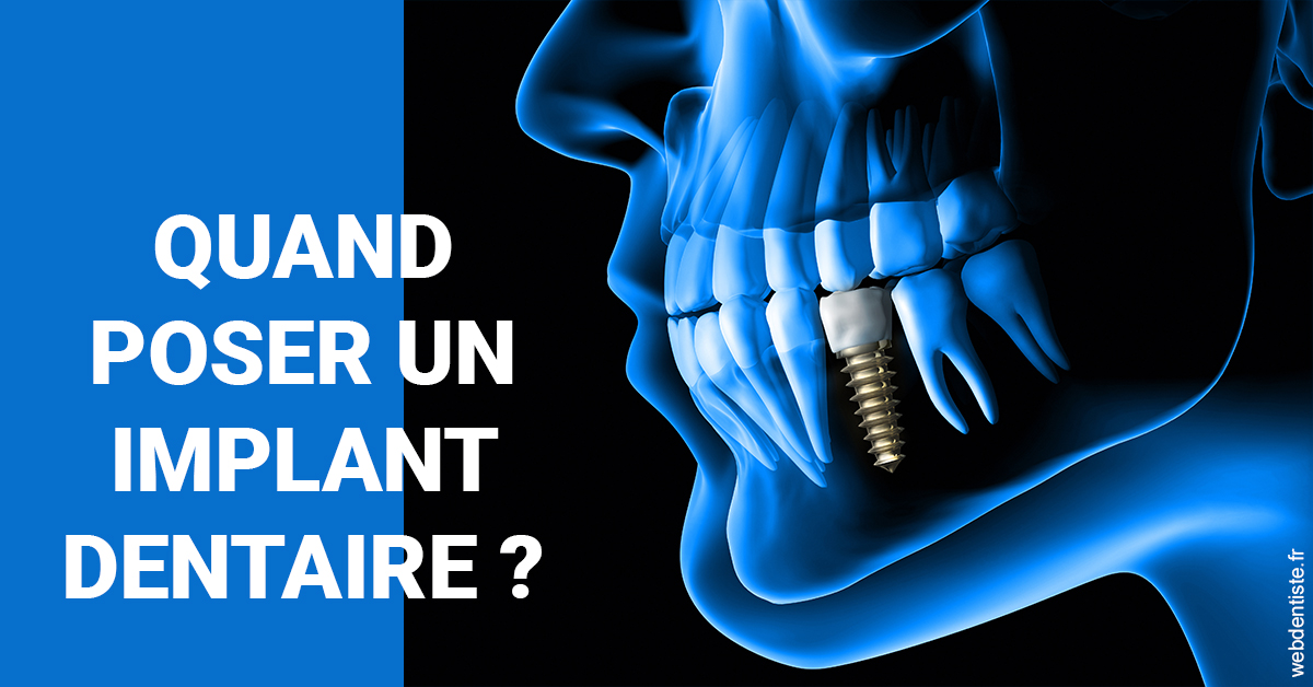 https://dr-perotti-laurent.chirurgiens-dentistes.fr/Les implants 1