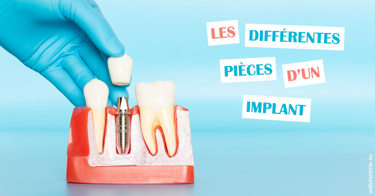 https://dr-perotti-laurent.chirurgiens-dentistes.fr/Les différentes pièces d’un implant 2