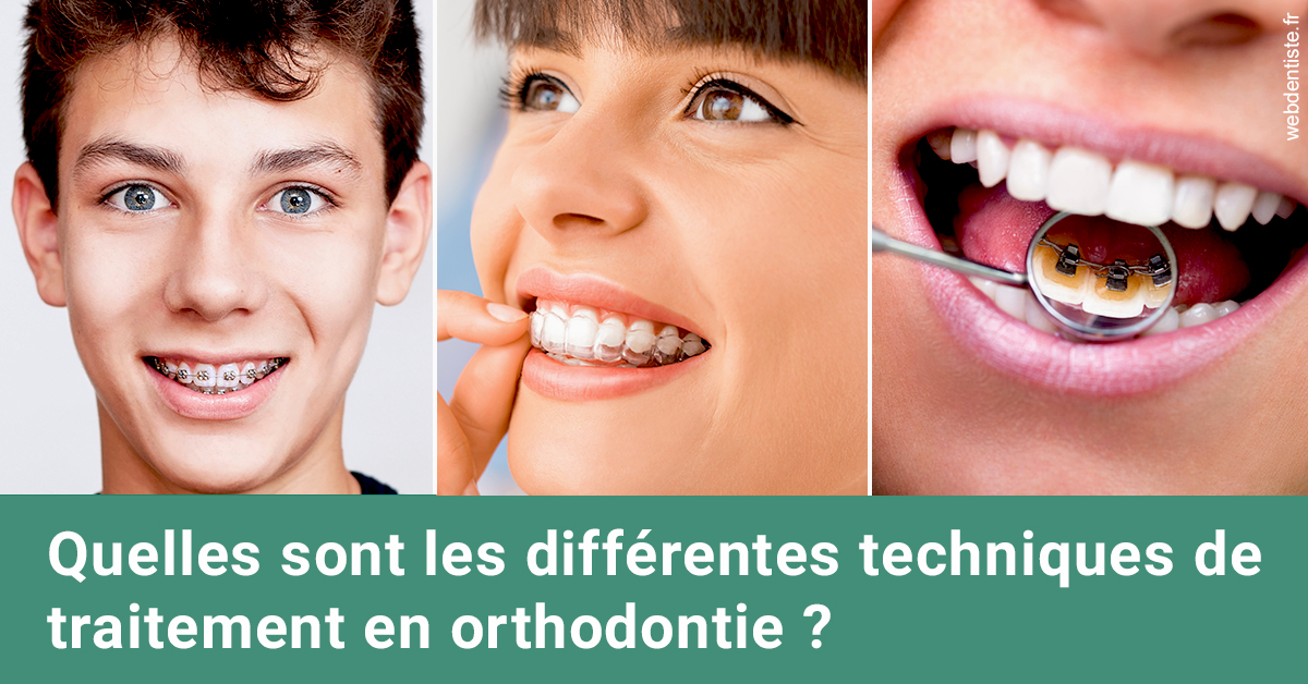 https://dr-perotti-laurent.chirurgiens-dentistes.fr/Les différentes techniques de traitement 2