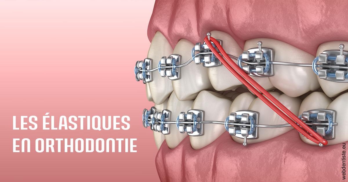 https://dr-perotti-laurent.chirurgiens-dentistes.fr/Elastiques orthodontie 2