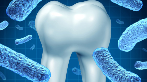 Thérapeutique initiale parodontale / Déchaussement dentaire