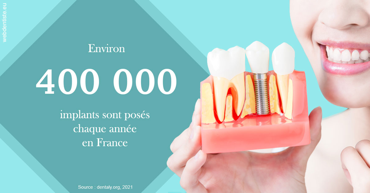 https://dr-perotti-laurent.chirurgiens-dentistes.fr/Pose d'implants en France 2