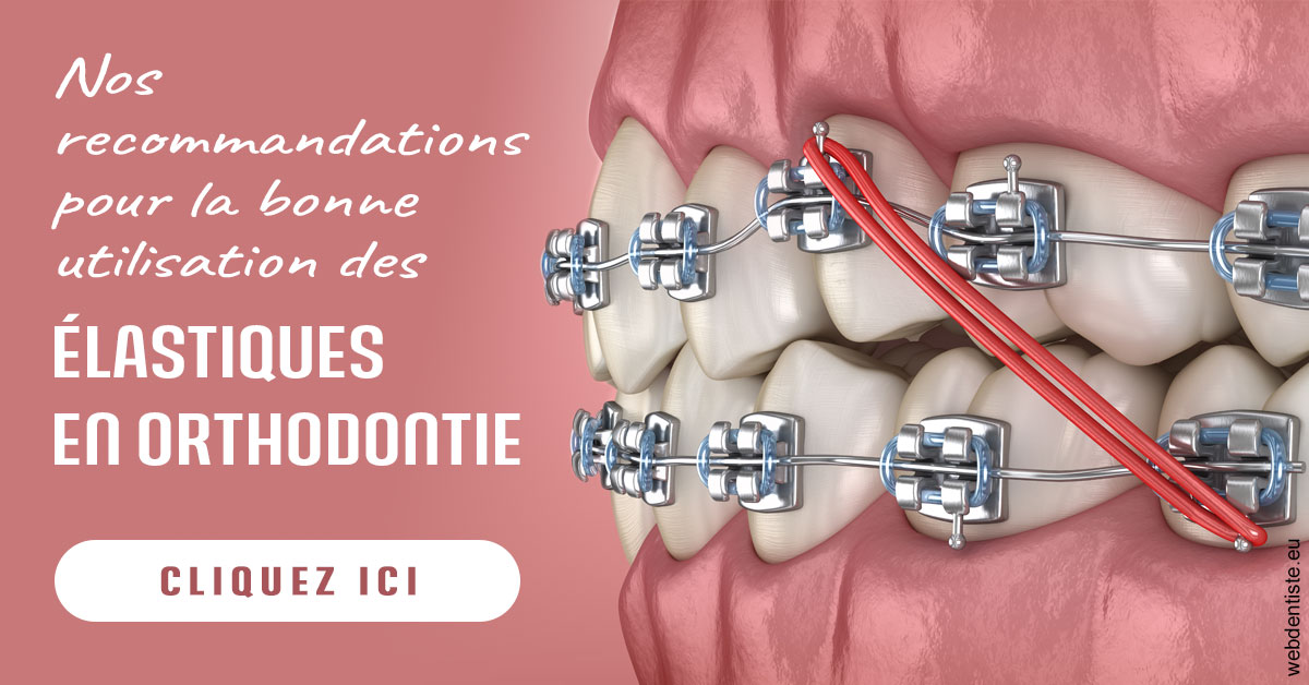 https://dr-perotti-laurent.chirurgiens-dentistes.fr/Elastiques orthodontie 2